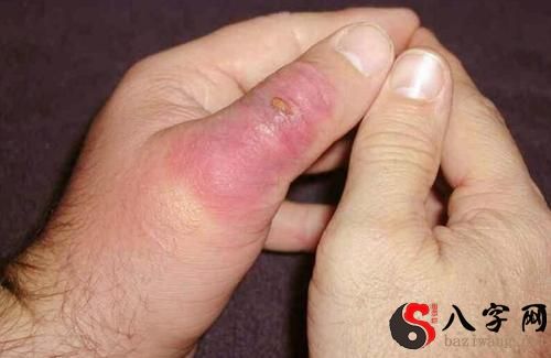 梦见自己被蜘蛛咬